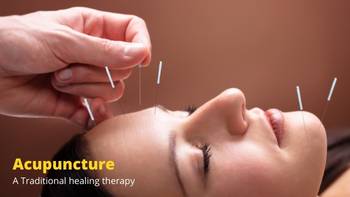 Acupuncture